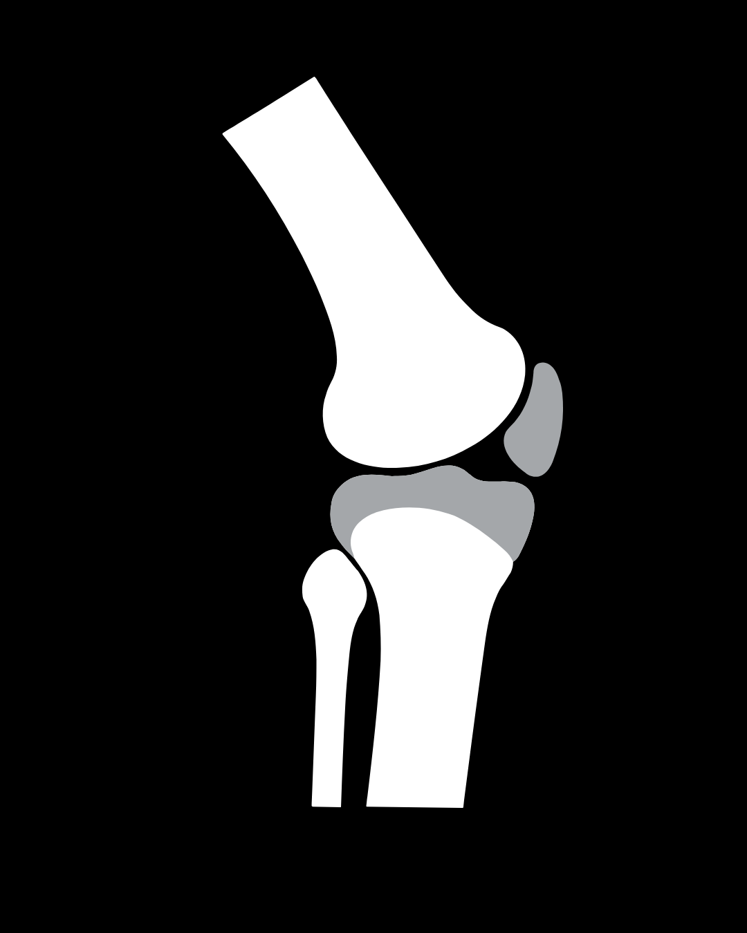 Sistema Articular